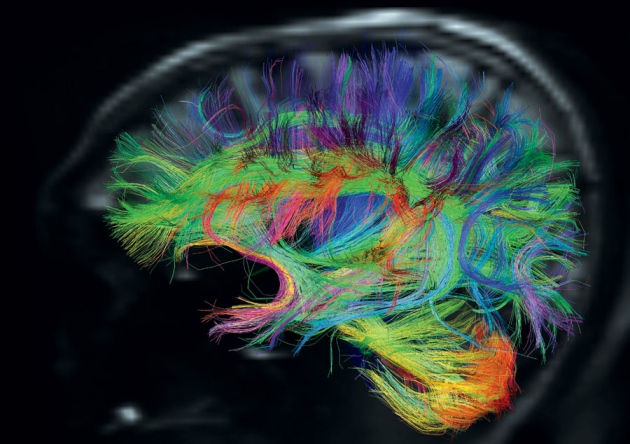 Rough map of a human connectome. ([Source](https://www.nature.com/news/neuroscience-making-connections-1.10260))